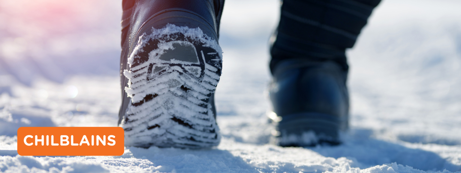 Chilblains – National Feet Week